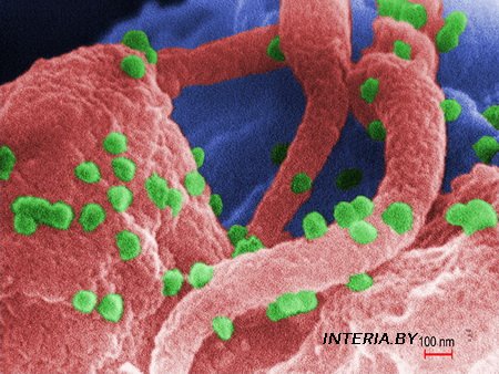 Исследователи определили происхождение пандемии ВИЧ