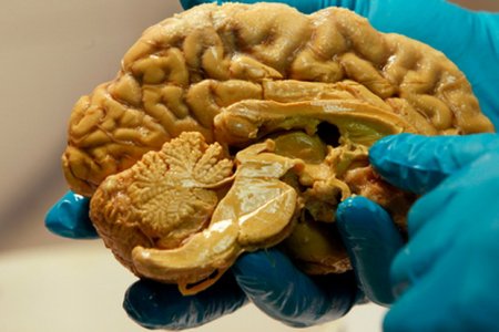 Разгадана главная тайна человеческого мозга