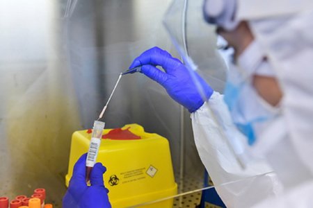 Эксперты ВОЗ отработали четыре версии передачи коронавируса человеку