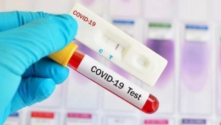 Белорусам предлагают бесплатно проверить антитела к коронавирусу