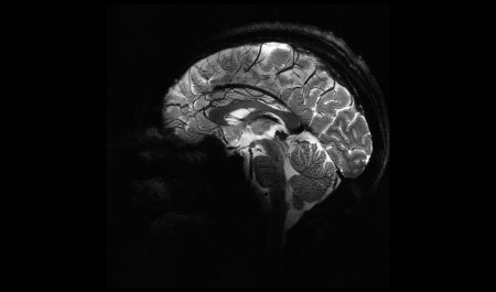 Самый мощный в мире МРТ сделал первые изображения человеческого мозга