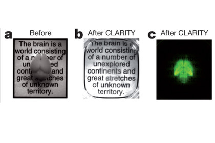 Нейробиологи научились делать мозг прозрачным